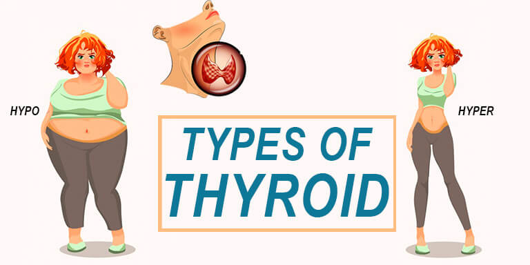 types of thyroid