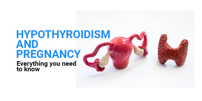 managing pregnancy with hypothyroidism